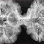 9 MK Gaurishankar 45.6mm 9.62gm - Xray