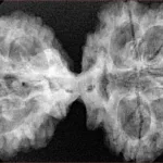 10 Mk Gaurishankar 42.4mm 8.24gm - Xray