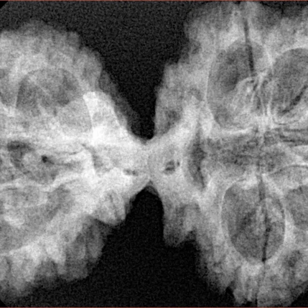 10 Mk Gaurishankar 42.4mm 8.24gm - Xray