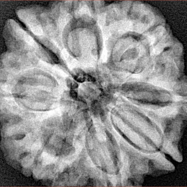 8 Mukhi Rudraksha 29.4mm 7.67gm - Xray