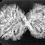 9 MK Gaurishankar 34.4mm 5.3gm - Xray