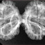 8 MK Gaurishankar 37.9mm 6.08gm - Xray