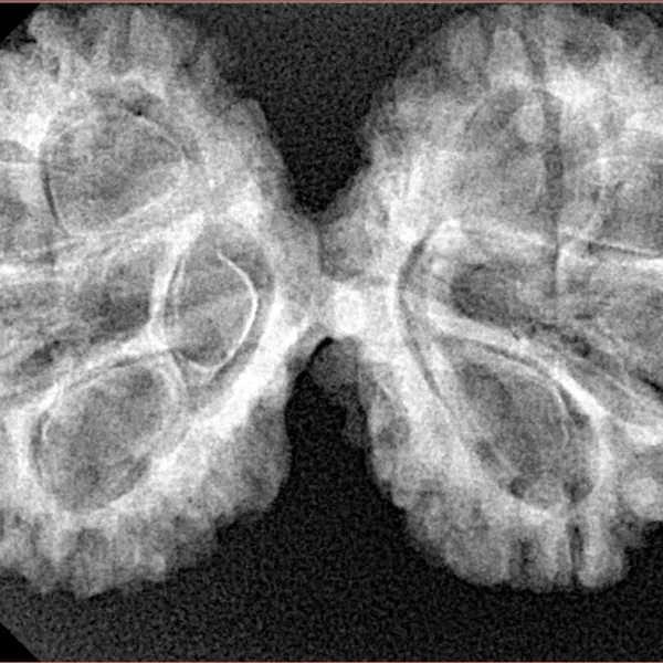 8 MK Gaurishankar 37.9mm 6.08gm - Xray