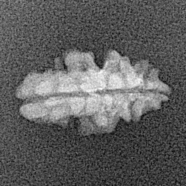 1 Mukhi Rudraksha 16.2mm 0.45gm - Xray