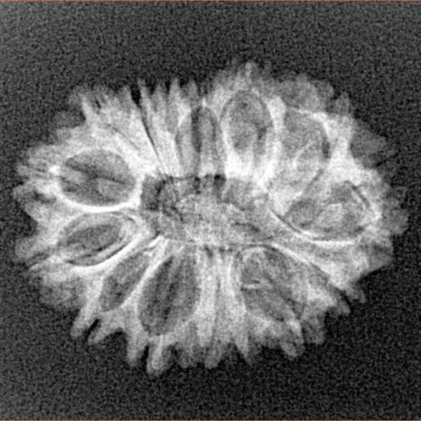 15 Mukhi Rudraksha 23.8mm 2.32gm - Xray