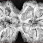 12 MK Gaurishankar 43.3mm 12.51gm - Xray
