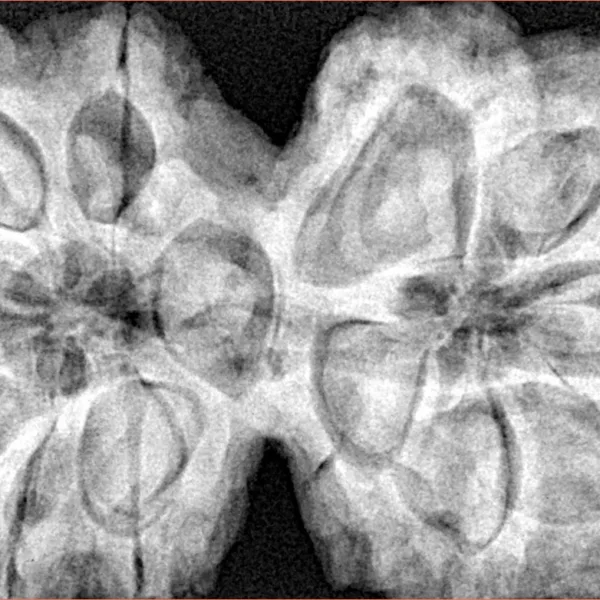 12 MK Gaurishankar 43.3mm 12.51gm - Xray