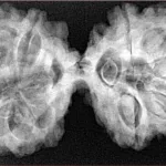 12 MK Gaurishankar 41.1mm 8.65gm - Xray