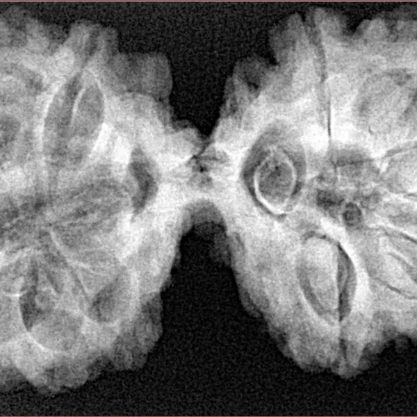 12 MK Gaurishankar 41.1mm 8.65gm - Xray
