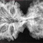 10 Mk Gaurishankar 40.2mm 6.87gm - Xray