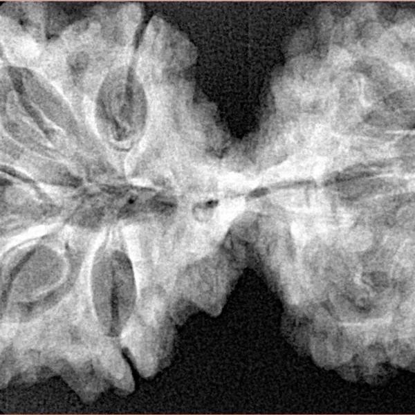 10 Mk Gaurishankar 40.2mm 6.87gm - Xray