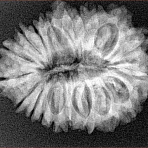 19 Mukhi Rudraksha 27.8mm 4.32gm - Xray