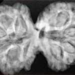 10 Mk Gaurishankar 38.5mm 8.65gm - Xray