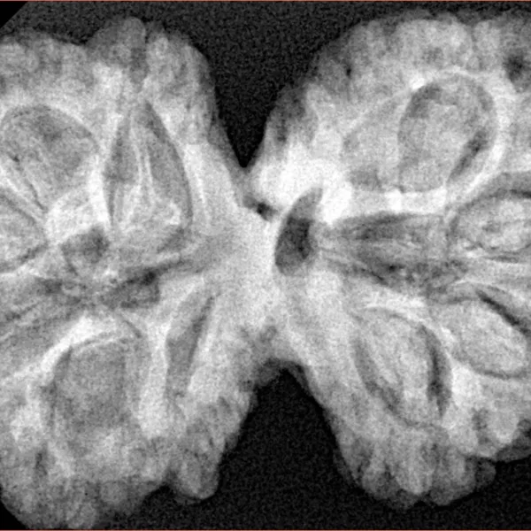 10 Mk Gaurishankar 38.5mm 8.65gm - Xray