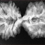 11 Mukhi Rudraksha 37.6mm 7gm - Xray