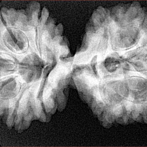 11 Mukhi Rudraksha 37.6mm 7gm - Xray