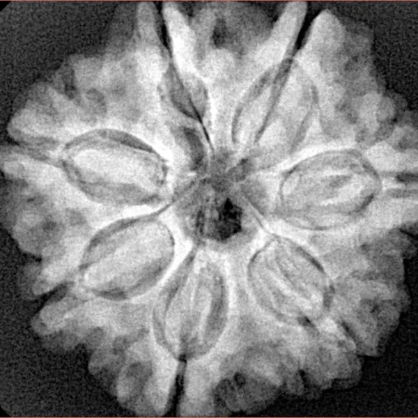 7 Mukhi Rudraksha 26.8mm 6.22gm - Xray