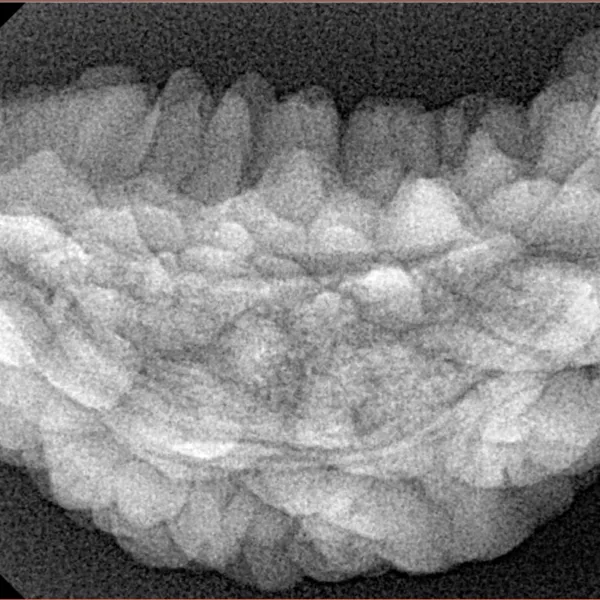 1 Mukhi Rudraksha 38.5mm 5.88gm - Xray