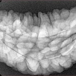 1 Mukhi Rudraksha 35.6mm 6.15gm - Xray