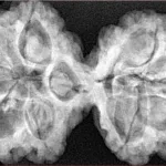 9 MK Gaurishankar 39.5mm 8.67gm - Xray