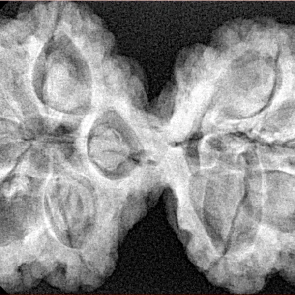 9 MK Gaurishankar 39.5mm 8.67gm - Xray