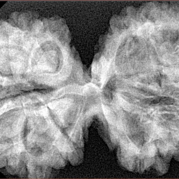 13 MK Gaurishankar 41.8mm 8.09gm - Xray