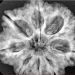 8 Mukhi Rudraksha 29.6mm 6.9gm - Xray
