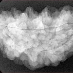 1 Mukhi Rudraksha 34.9mm 5.98gm - Xray