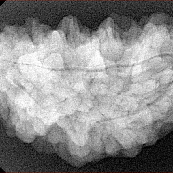 1 Mukhi Rudraksha 34.9mm 5.98gm - Xray