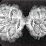 10 Mk Gaurishankar 35.1mm 5.5gm - Xray