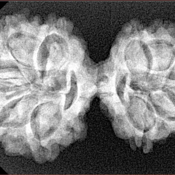 10 Mk Gaurishankar 35.1mm 5.5gm - Xray