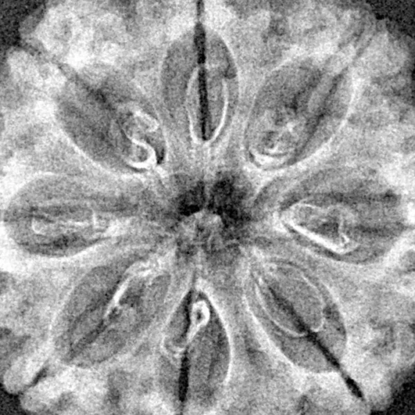 8 Mukhi Rudraksha 29.2mm 5.06gm - Xray