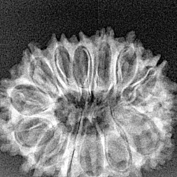 14 Mukhi Rudraksha 27.2mm 3.3gm - Xray