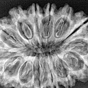 14 Mukhi Rudraksha 34.1mm 6gm - Xray