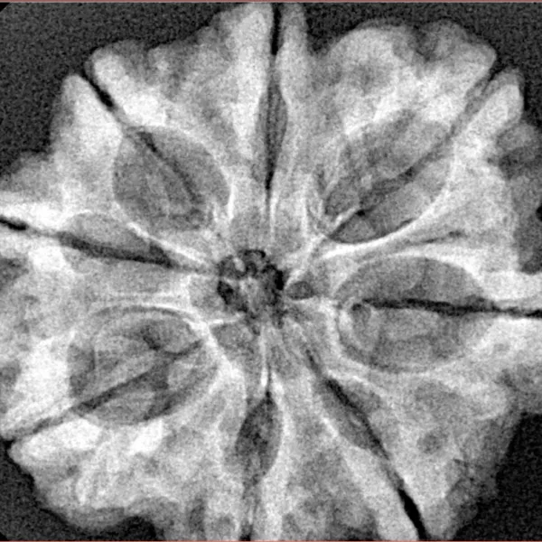 8 Mukhi Rudraksha 29.4mm 5.85gm - Xray