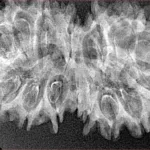 16 Mukhi Gaurishankar 37.9mm 4.94gm - Xray