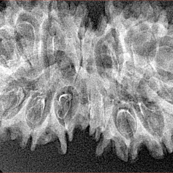 16 Mukhi Gaurishankar 37.9mm 4.94gm - Xray