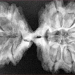 11 MK Gaurishankar 41.9mm 8.05gm - Xray