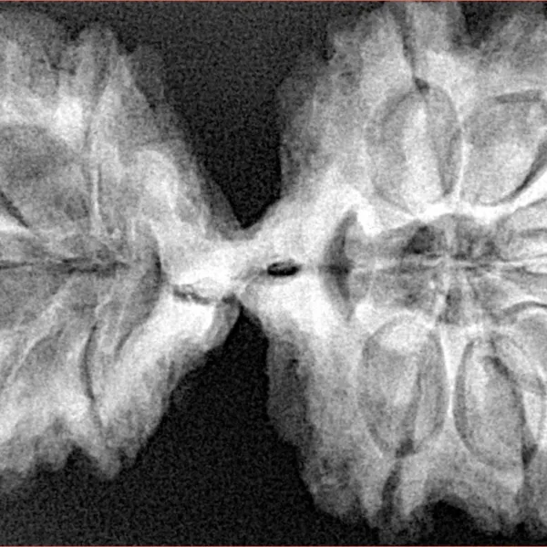 11 MK Gaurishankar 41.9mm 8.05gm - Xray