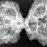 9 Mukhi Mini Trijuti 42.7mm 9.93gm - Xray