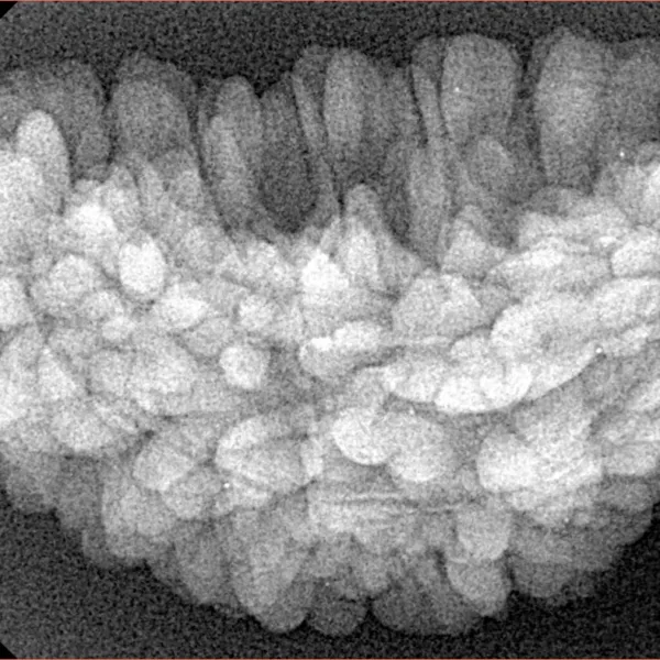 1 Mukhi Rudraksha 34.6mm 5gm - Xray
