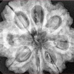 8 Mukhi Rudraksha 29.3mm 8.11gm - Xray