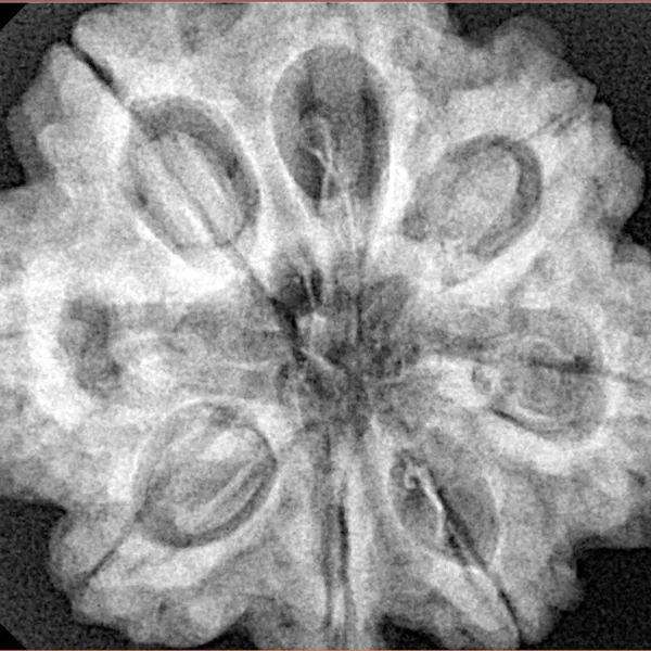 8 Mukhi Rudraksha 29.3mm 8.11gm - Xray