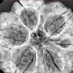 6 Mukhi Rudraksha 32.5mm 7.62gm - Xray