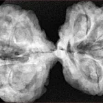 9 MK Gaurishankar 42.2mm 10gm - Xray