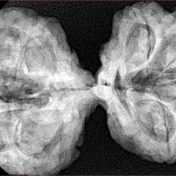 9 MK Gaurishankar 42.2mm 10gm - Xray