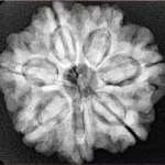 7 Mukhi Rudraksha 26.1mm 5.69gm - Xray