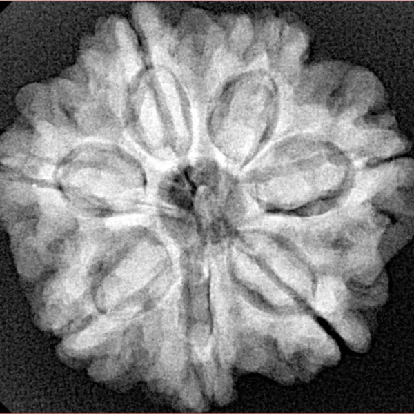 7 Mukhi Rudraksha 26.1mm 5.69gm - Xray