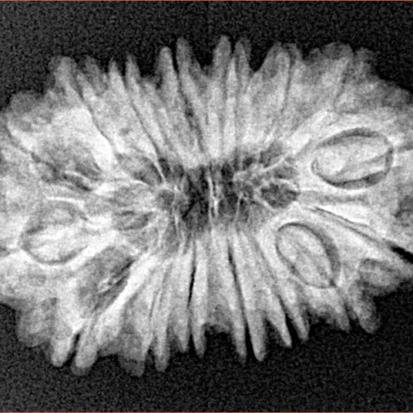16 Mukhi Rudraksha 28mm 3.72gm - Xray