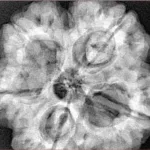 5 Mukhi Rudraksha 31.1mm 9.64gm - Xray